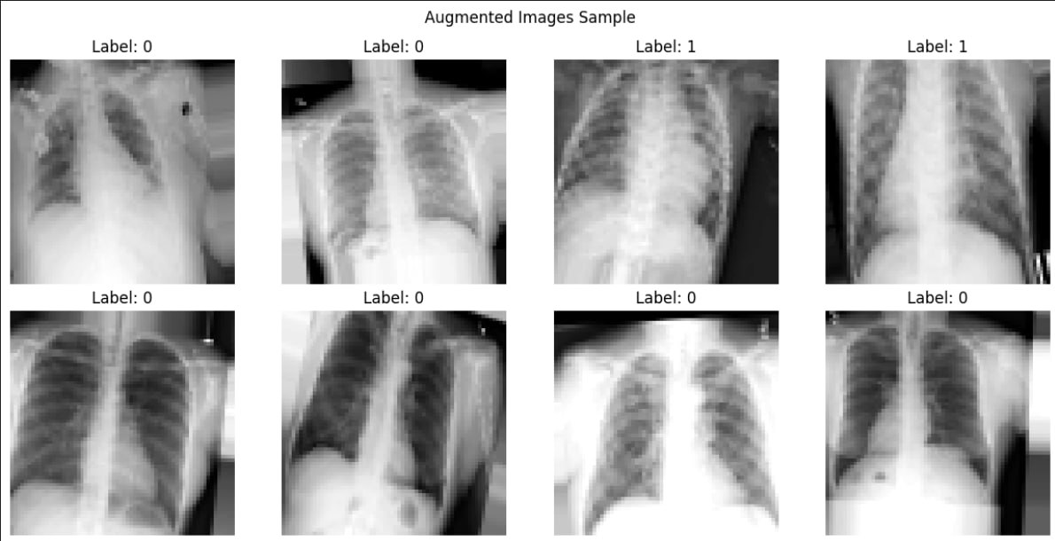 Model classification CNN Pneumonia screenshot 3