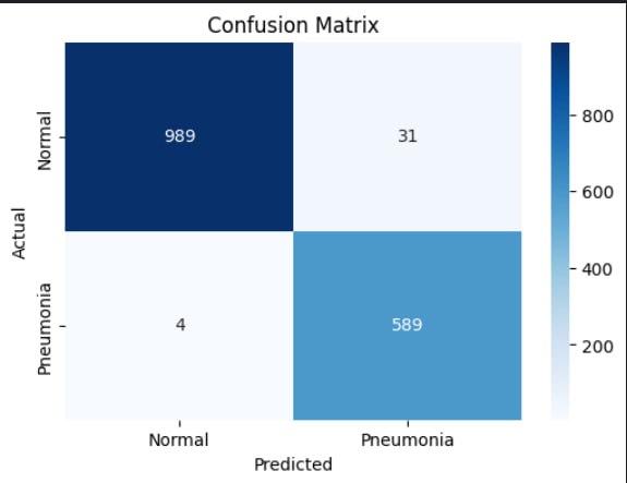 Model classification CNN Pneumonia screenshot 1
